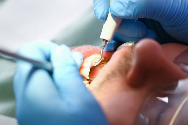 Best Urgent Care for Lost Fillings or Crowns in Webster Groves, MO
